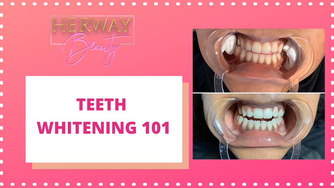 Teeth Whitening 101